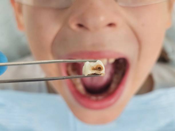 Best Emergency Treatment for Toothache in Hart, MI